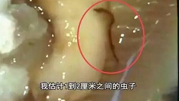 一只生蠔引起的冤案，觸動了餐飲人的“麻木神經(jīng)”